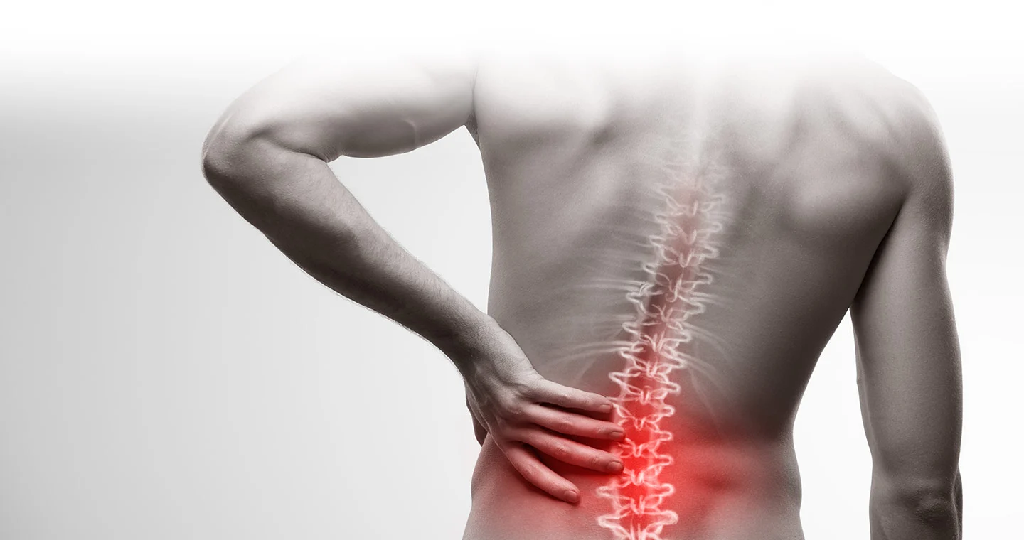 How to Recover from Spinal Surgery